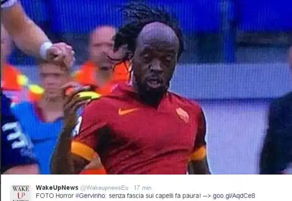 Sui social network fioccano i commenti sulla fronte spaziosa dell'attaccante della Roma, che ha perso la sua fascetta nel corso della partita contro il Cagliari.