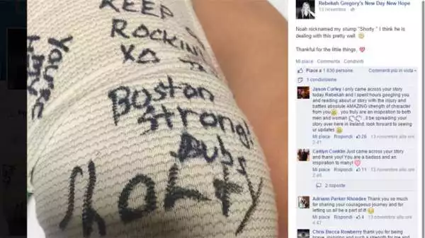 La ventisettenne è riuscita a sopravvivere all'attentato della Maratona di Boston ma dopo più di un anno e mezzo si è fatta amputare la gamba.