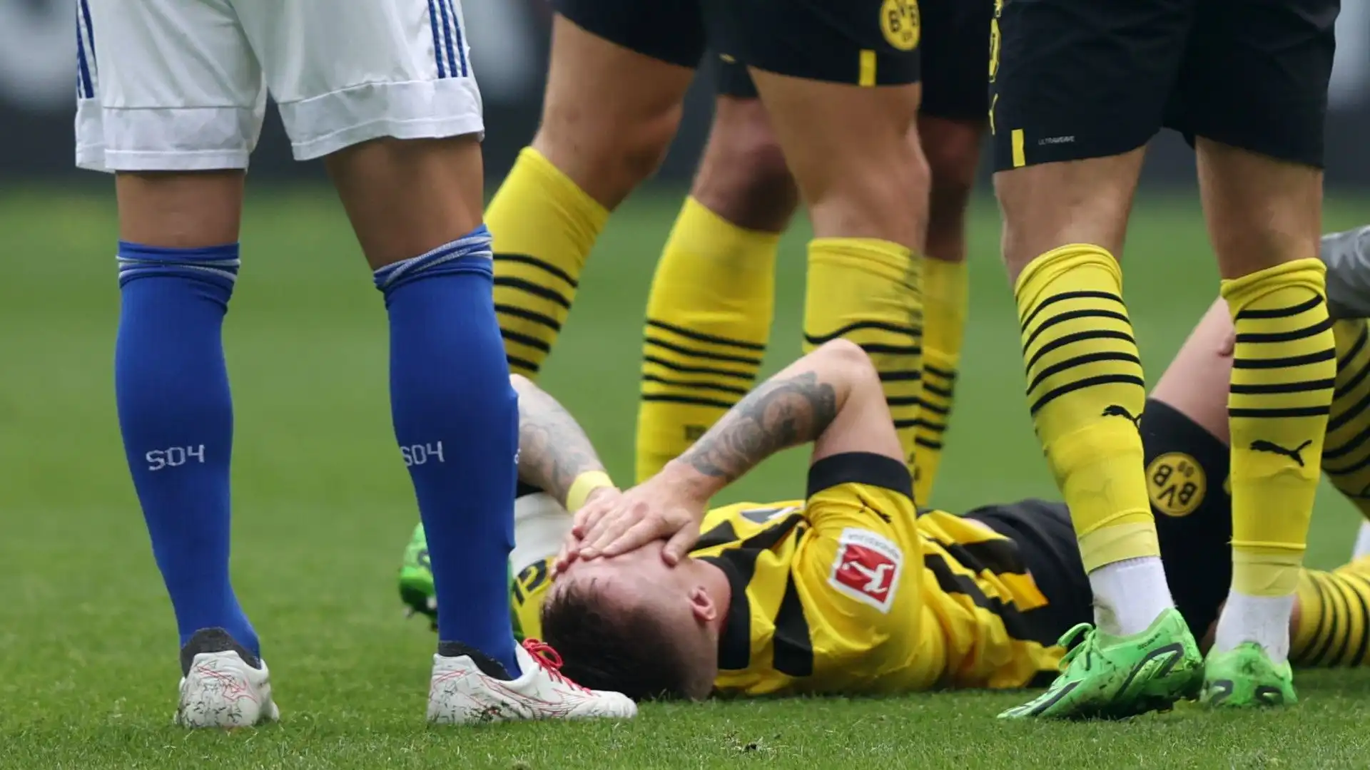 Nella partita tra Borussia Dortmund e Schalke 04 il tedesco ha subito un bruttissimo infortunio