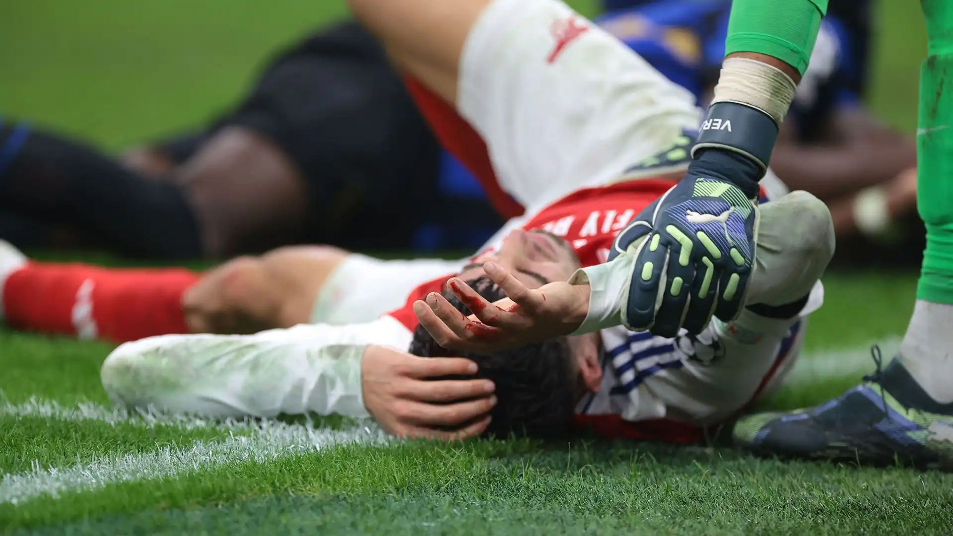 Che spavento per Kai Havertz! Ferito alla testa e soccorso dai medici. Foto