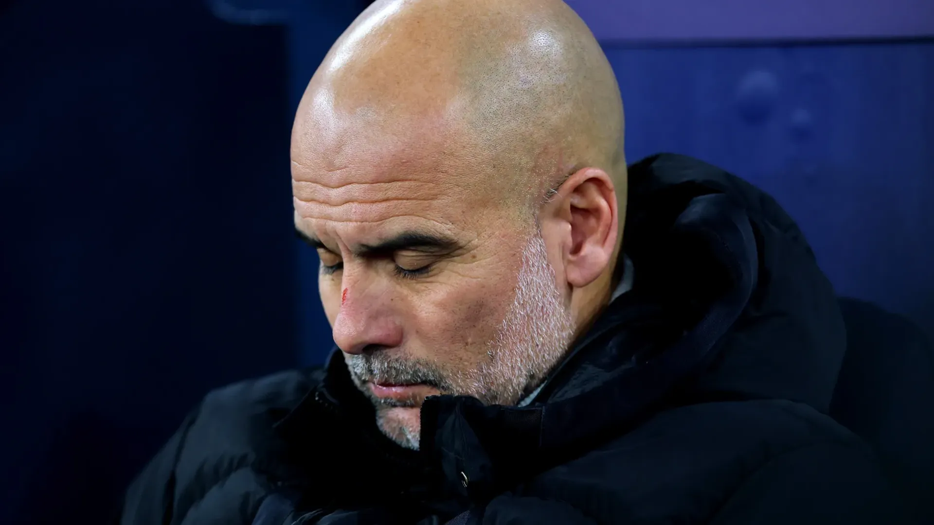 Guardiola distrutto va in TV con graffi e ferite: le sue parole spiazzano i tifosi